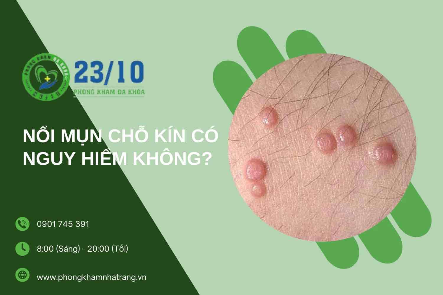 Thủ phạm gây nổi mụn chỗ kín