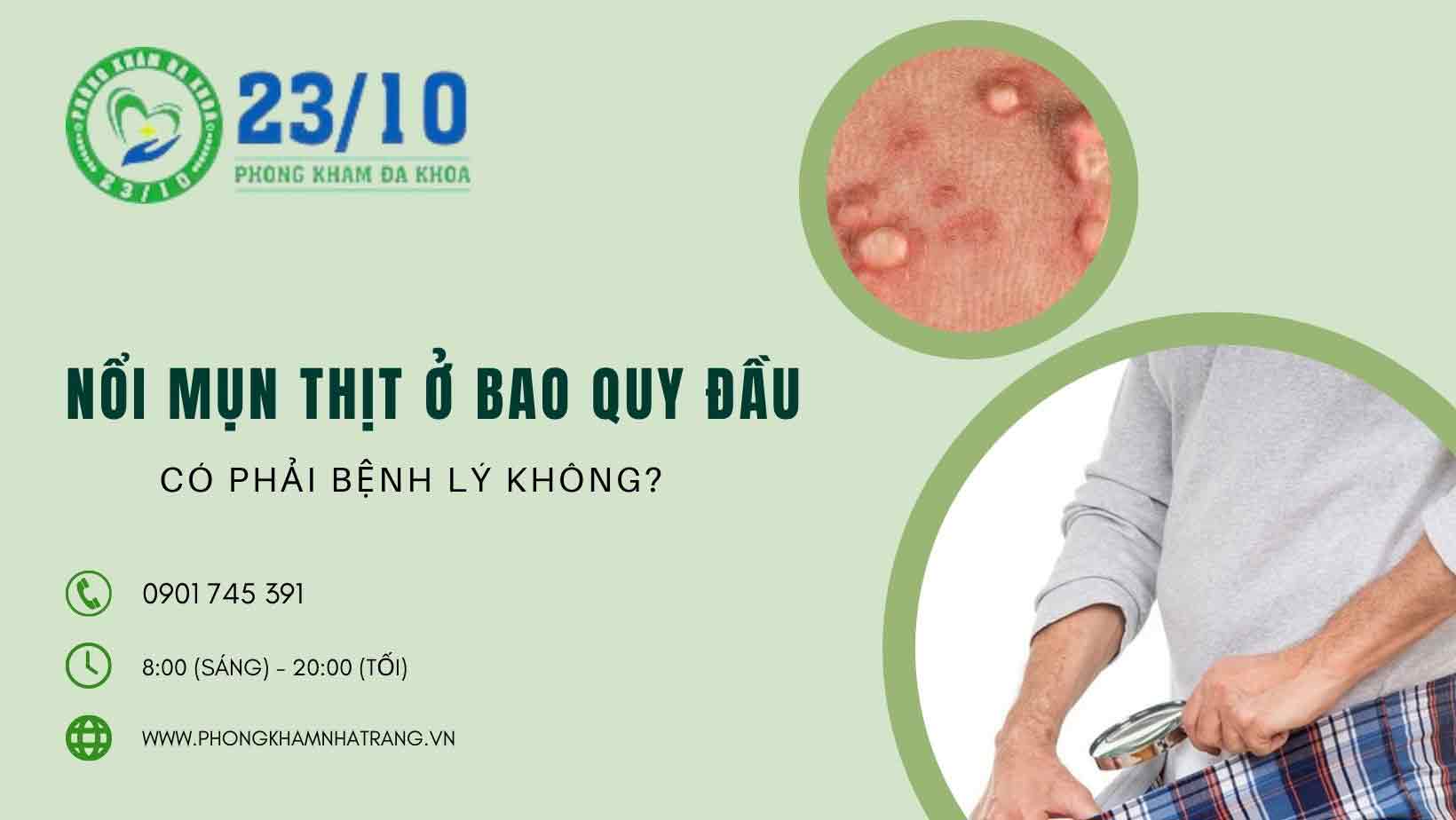 Nguyên nhân gây nổi mụn thịt ở bao quy đầu