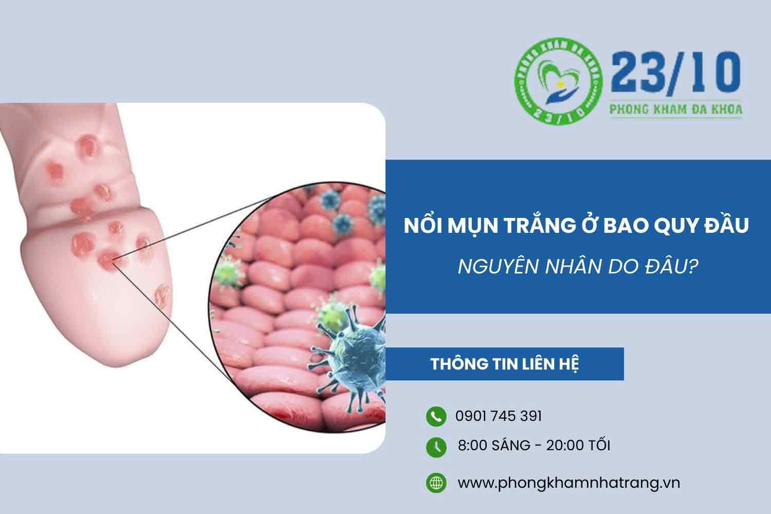 Bao quy đầu nổi mụn trắng là do đâu?