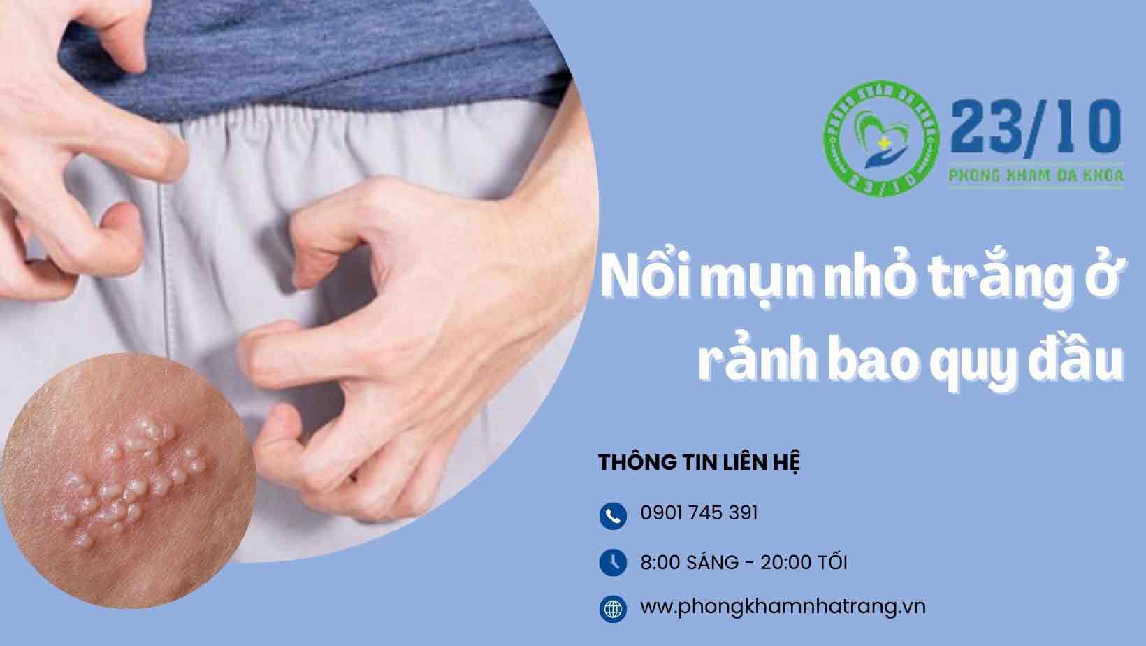  Có thể là dấu hiệu của một số bệnh