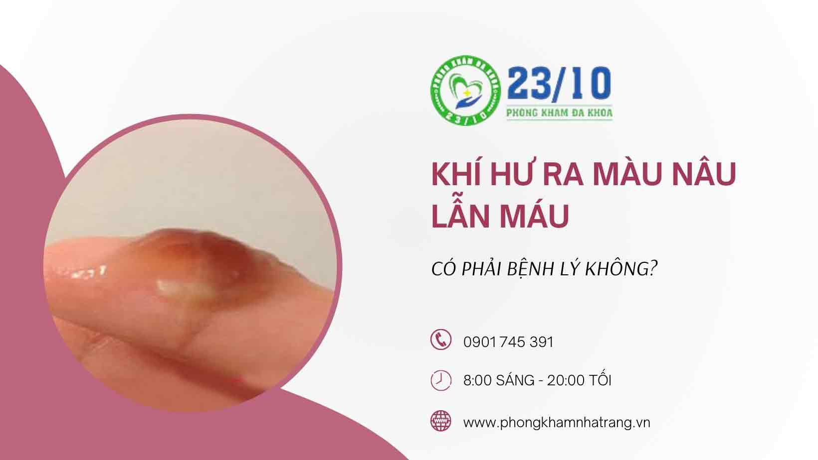 Nguyên nhân gây ra khí hư màu nâu lẫn máu