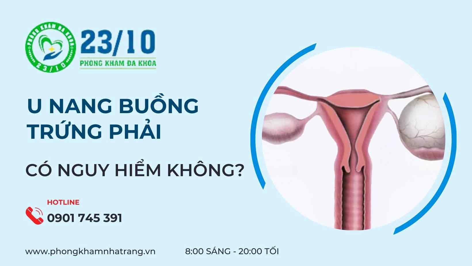 Tại sao bị u nang buồng trứng phải?