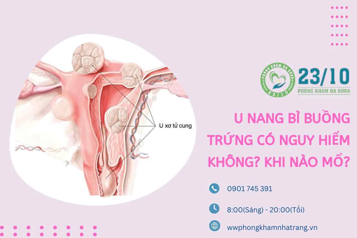 Hình ảnh u bì buồng trứng