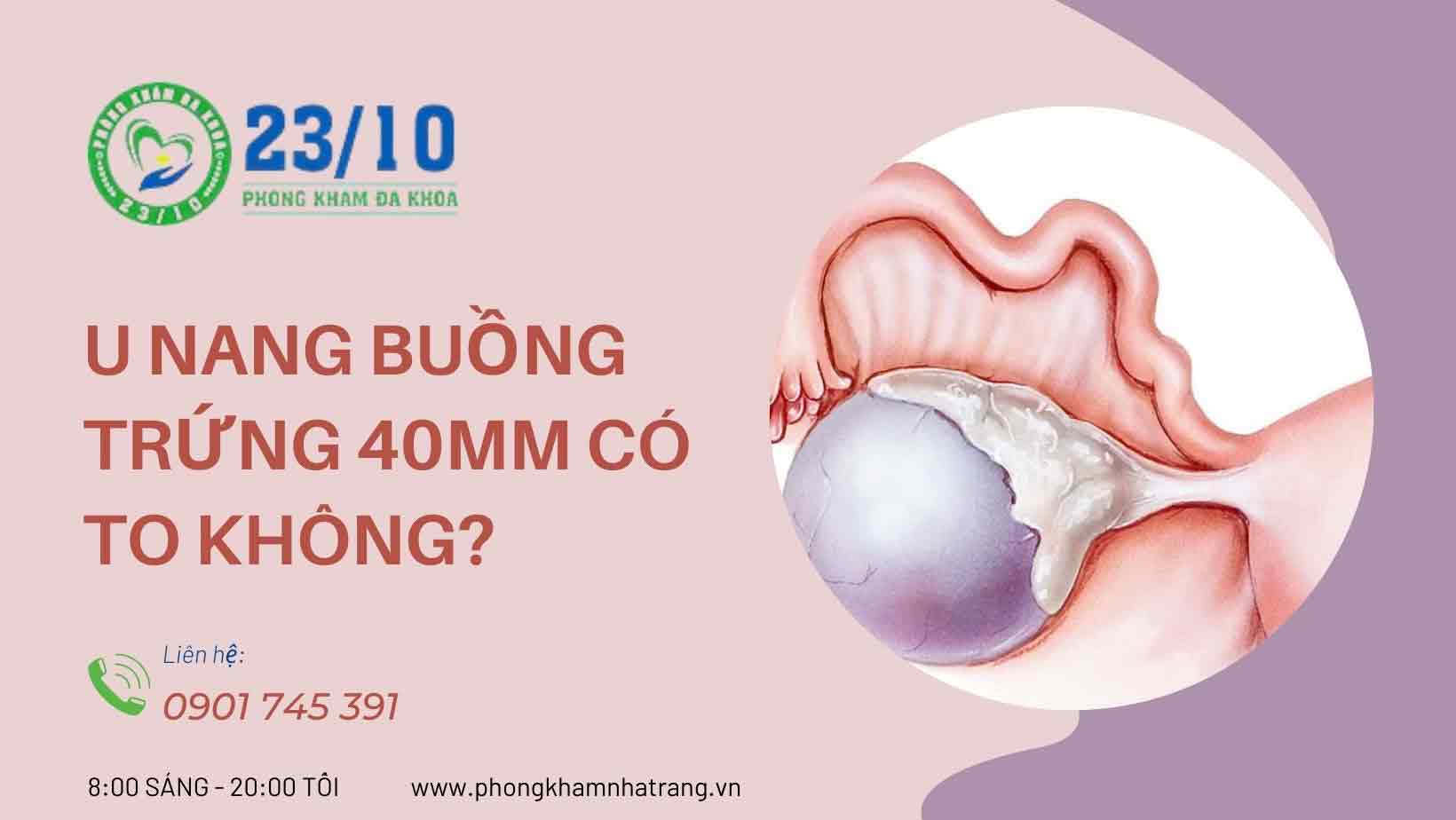 Dấu hiệu cho thấy bạn bị u nang buồng trứng