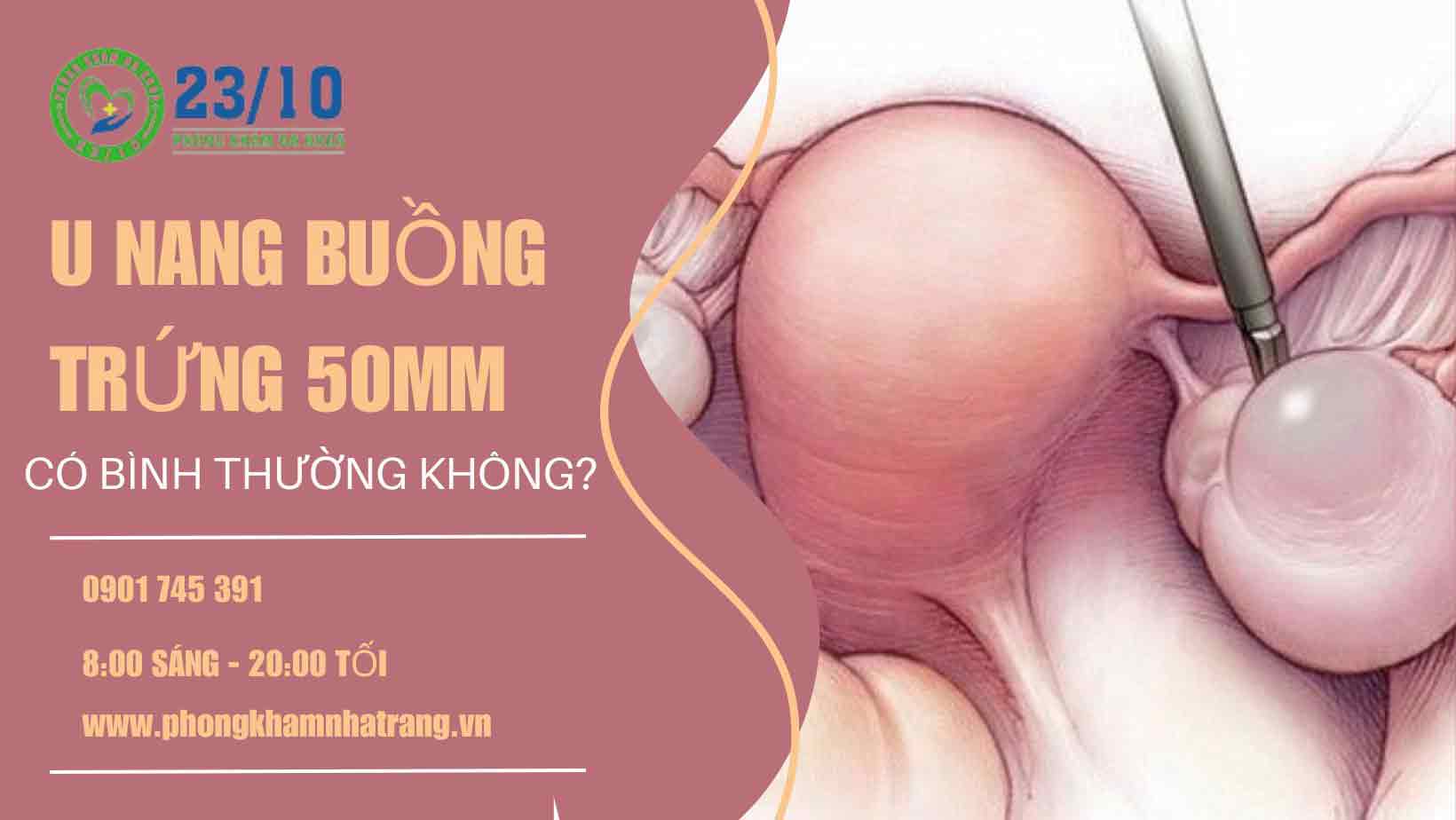 Kích thước nang buồng trứng bình thường là bao nhiêu?