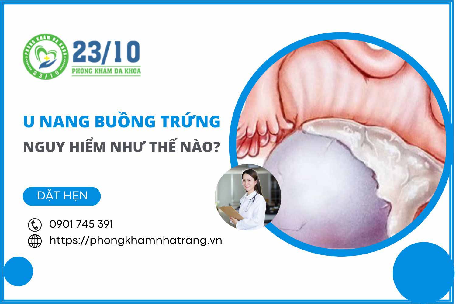 Hình ảnh u nang buồng trứng ở nữ giới