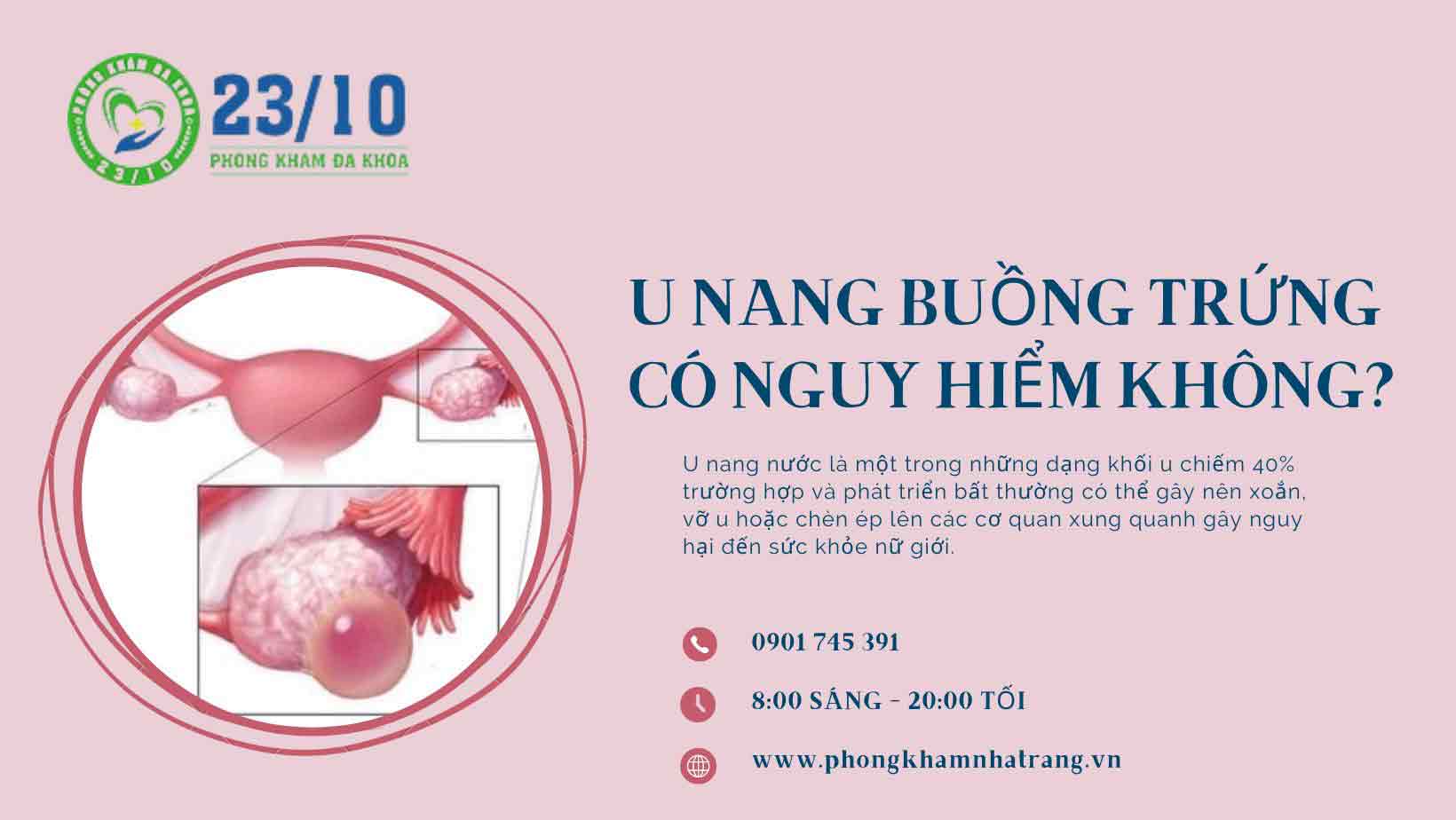 Hình ảnh u nang buồng trứng