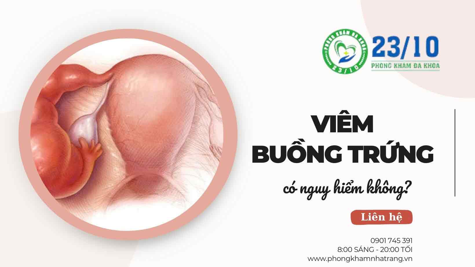 Dấu hiệu viêm buồng trứng