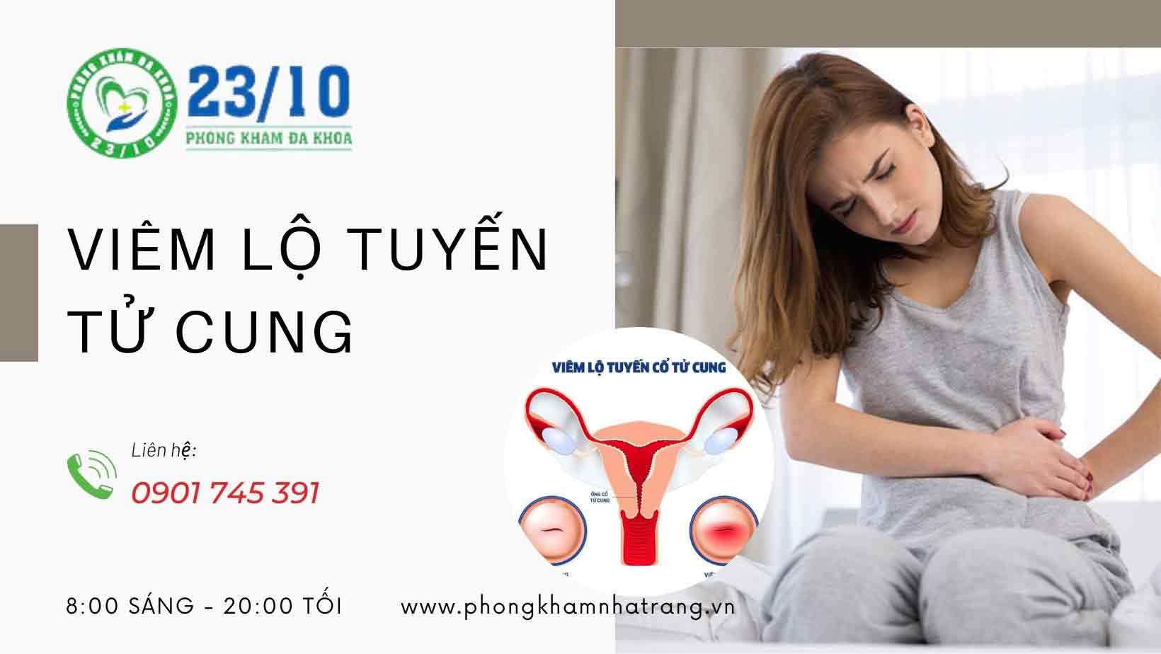 Bệnh viêm lộ tuyến tử cung là gì?