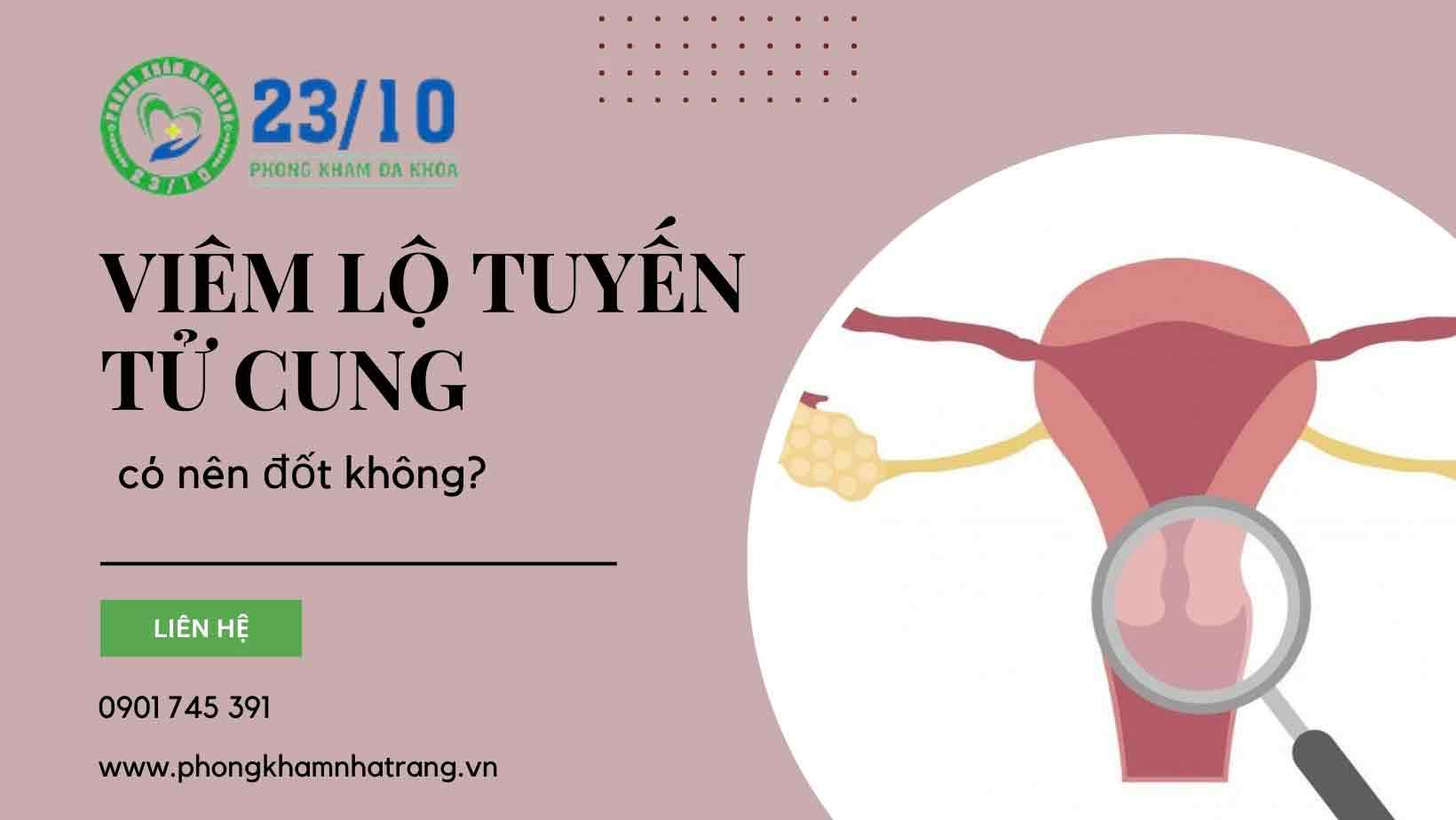 Đốt viêm lộ tuyến tử cung có tác hại gì không?