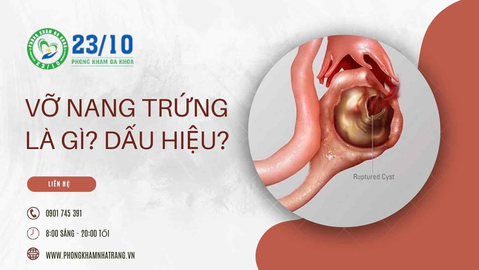 Vỡ nang trứng là gì?